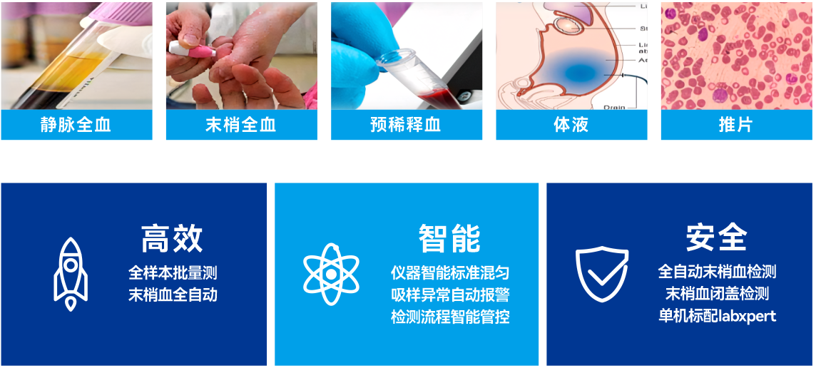 CAL-7000血液分(fēn)析流水線(xiàn)